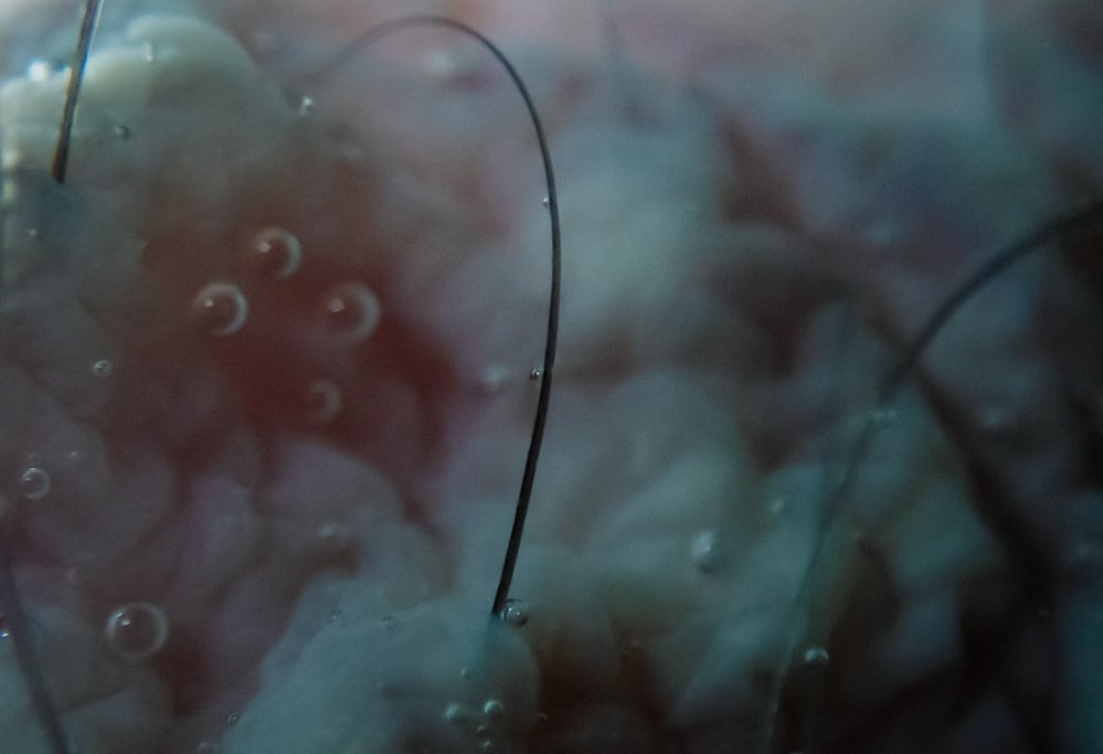 underwater flora #3, branched form bearing droplets against teal background, 2019